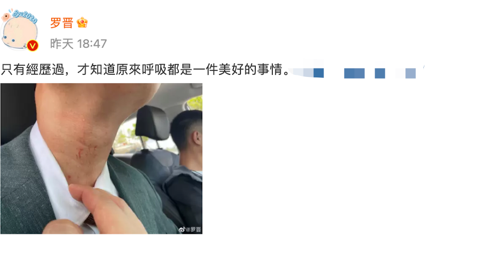 演员罗晋拍戏被勒脖子到窒息！青筋暴起眼球充血，脖子上伤痕明显