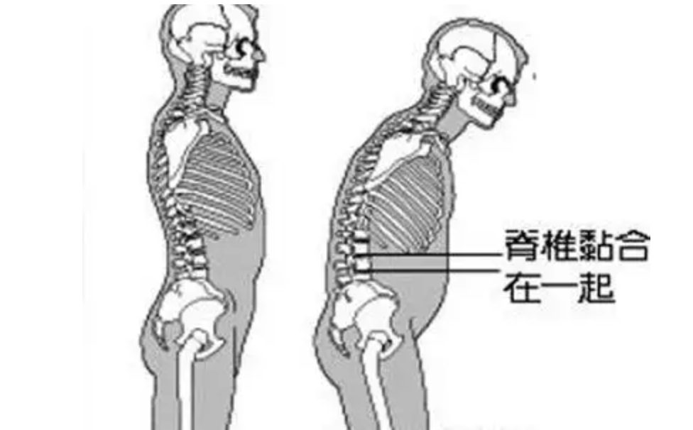 李宇春自曝身患重病，严重时需要坐轮椅：世事难料，人生无常