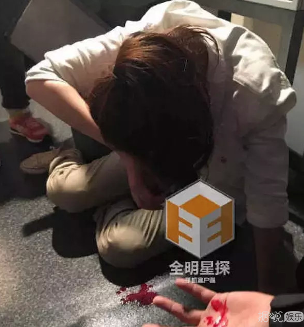 于小彤拍戏时被威亚勒住脖子，看完后觉得整个人都不好了
