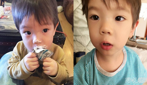 摩擦摩擦！独家揭秘杜江儿子嗯哼的欧式大双眼皮制造过程