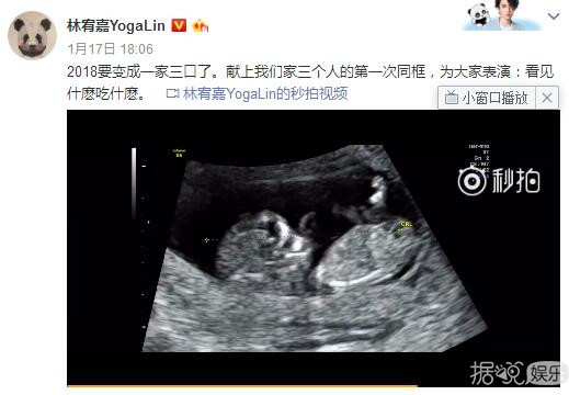跟他合照就一定会怀孕,转发锦鲤都没这么灵啊! 跟他合照就一定会怀孕,转发锦鲤都没这么灵啊!