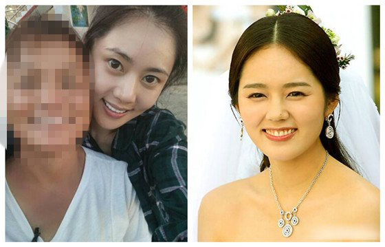 秋瓷炫整容了吗 秋瓷炫整容前后对比照大妈变美女 秋瓷炫整容了吗 秋瓷炫整容前后对比照大妈变美女