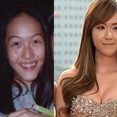 崔雪莉整容被曝光 整容前依然是大美人 崔雪莉整容被曝光 整容前依然是大美人